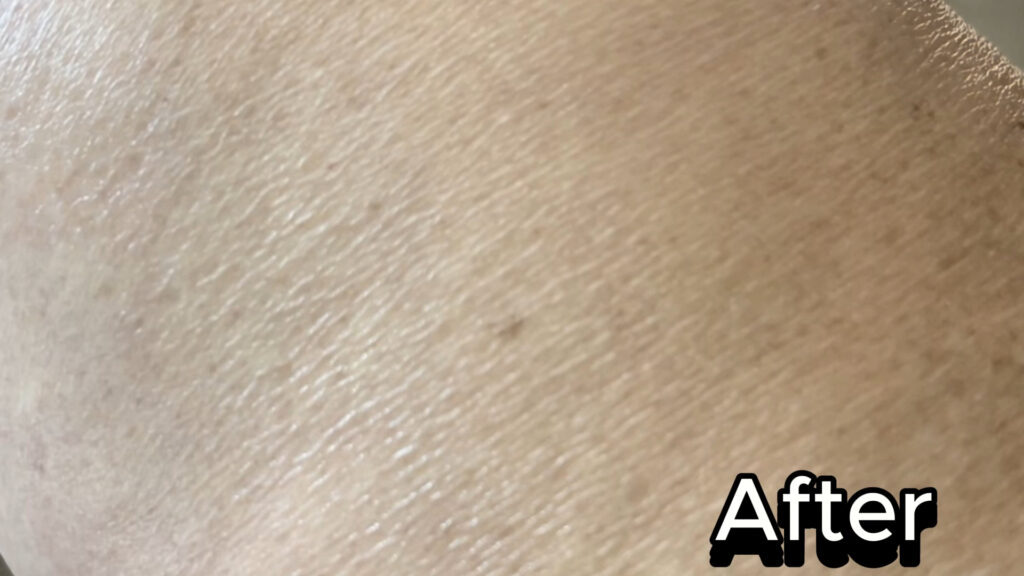 after using Gold bond Age renew