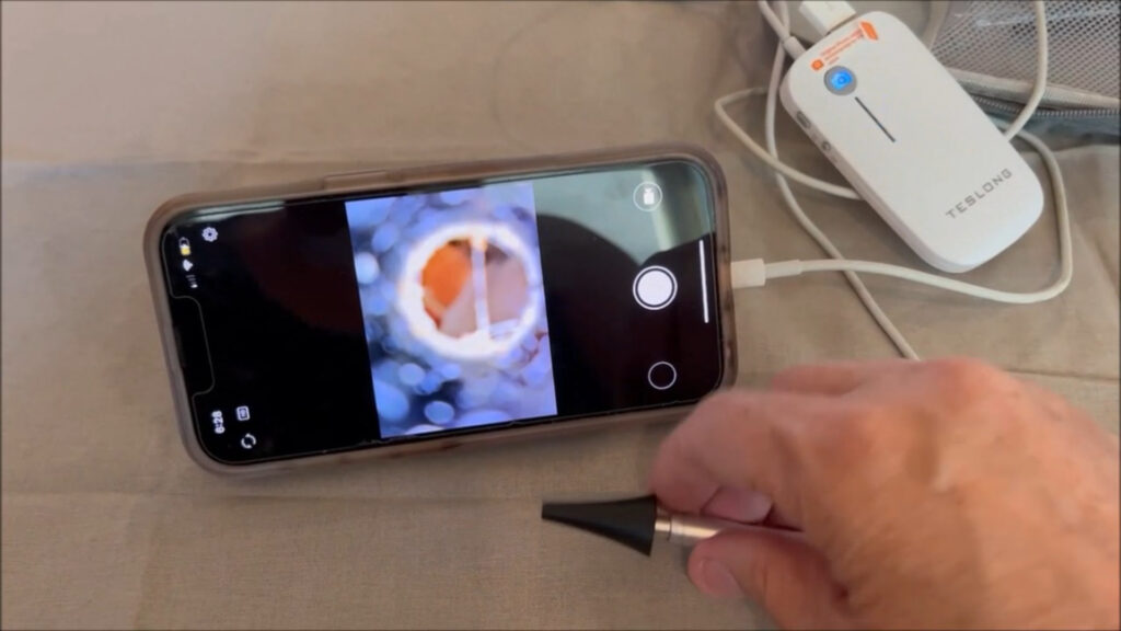 digital otoscope with light connected to smartphone